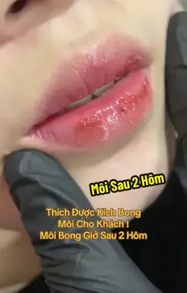 Thời Điểm Vàng Phun Môi đón Tết rồi đó Chị em à. #phunmoitunhien #khuthammoi #maysoitunhien #phuntheuthienhuong #tpvinh 