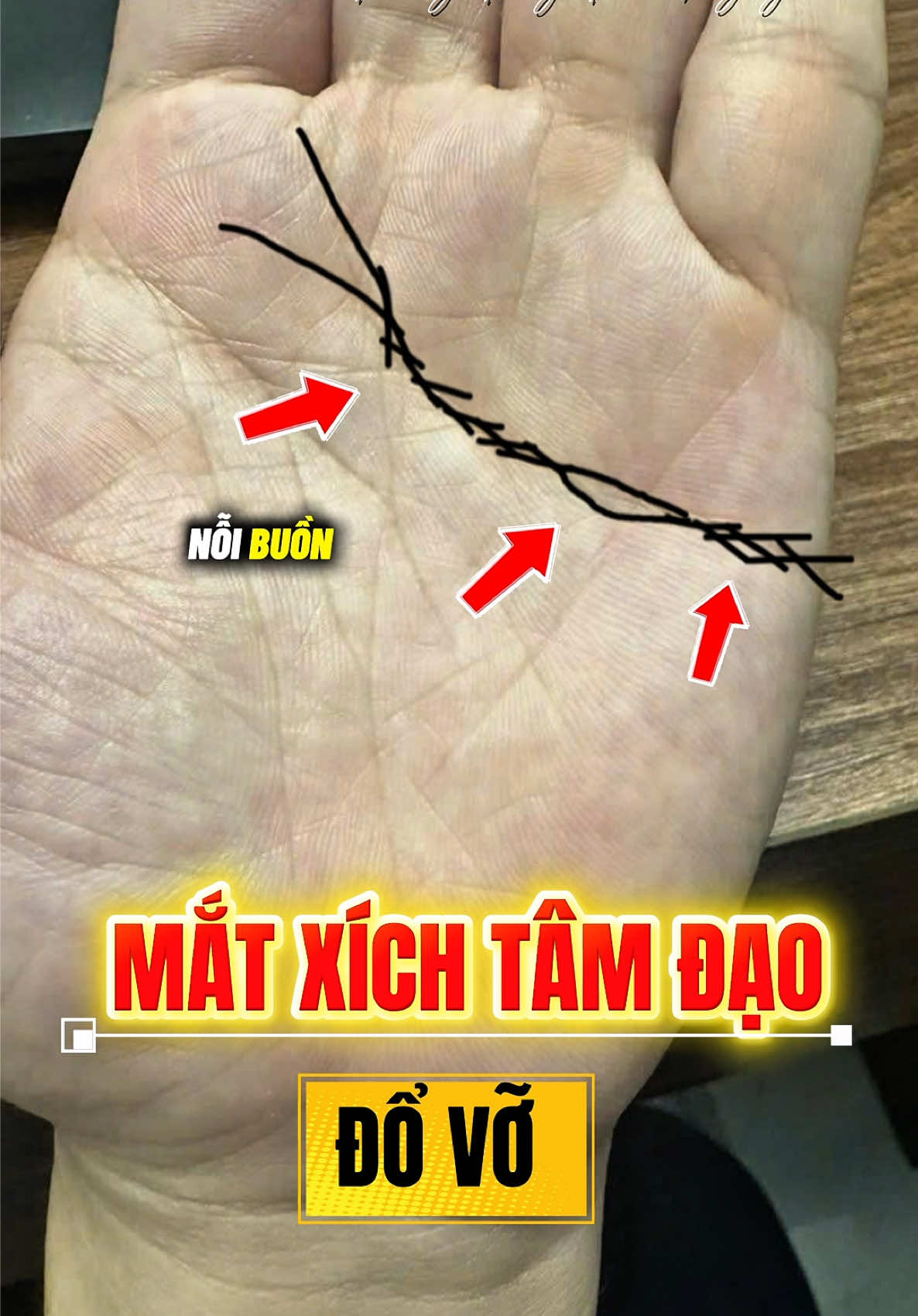 Nét chỉ tay buồn đường Tâm Đạo. Bạn xem của mình như thế nào nhé. Để giải mã chỉ tay #giaimachitay #0974569545xemchitay #phongthuythaonguyen #trungnhantuong37 