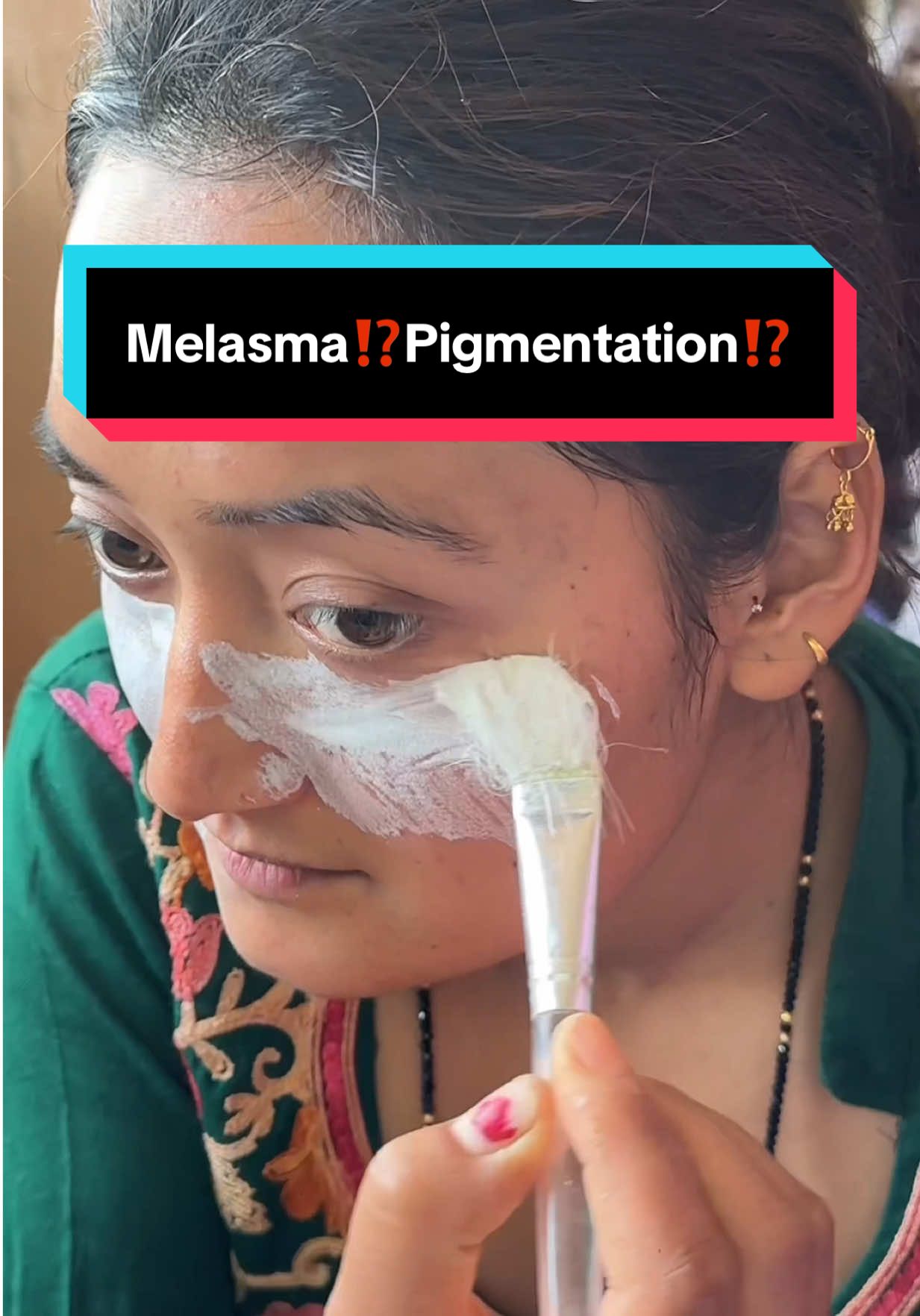Chaya poto, pigmentation ani dull skin ko solution 💕 Pearl Powder pre-order ma cha heavy discount ka saath 😍😍 . . . #melasma #melasmatreatment #pigmentation #clearskin #skincare 