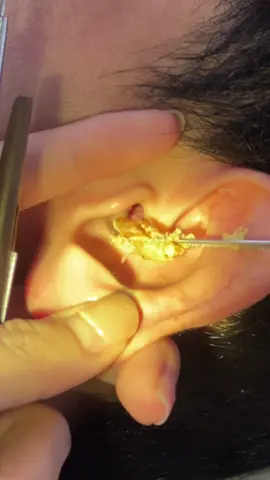 Nghe tới bên cam👂🏽