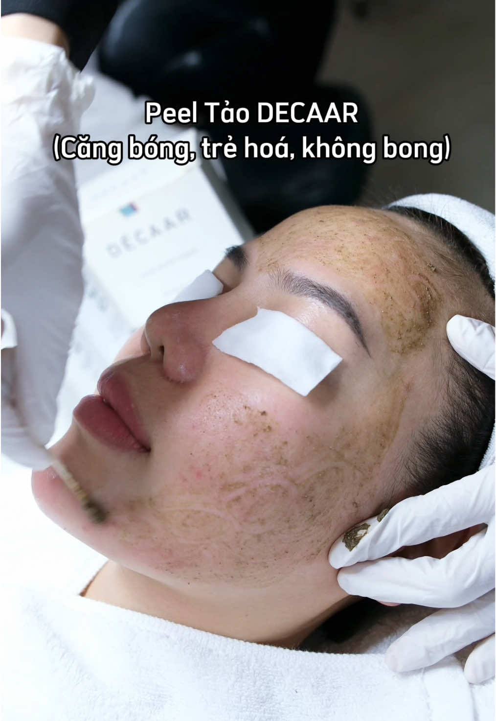 Bạn đã sẵn sàng cùng NQSPA peel da đón tết chưaaaa??😍#trimundanang #spadanang #peel #chamsocda #xuhuong 