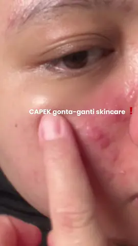 Pernah gak sih merasa lelah ganti skincare mulu tapi ga berasa apa-apa ? mending langsung cek air kamu deh pakai @Ellara.id Filter Shower 🚿 bisa jadi salah satu problemnya dari 💦  #SpaAlaEllara #ellara #water #air #acne 