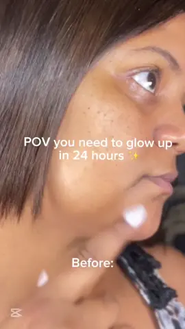 I love the result #dryskin  # barriercream  #skinbarrier  #acneprone  #skintok  #urbanand  @urbanand.official 