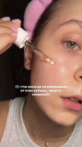 подробнее про процедуру в тгк cwestere #постакне #рубцы #субцизиярубцов 