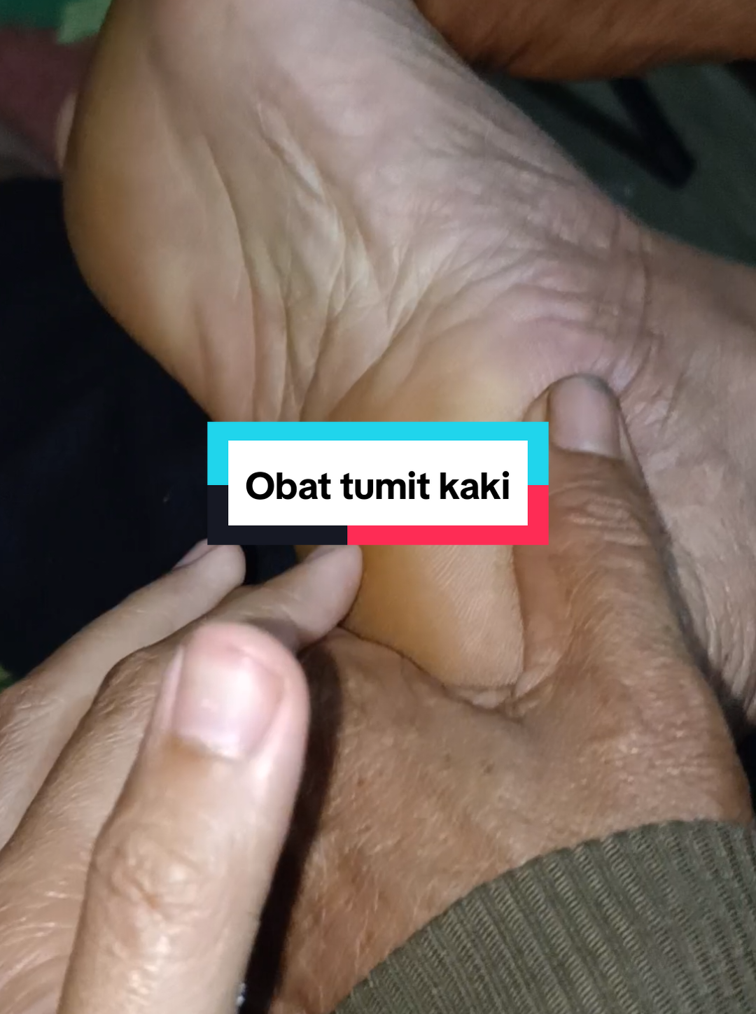 tumit telapak kaki mamaku sakit 😨.. lagsung checkout obat e, cek ndek keranjang kuning #plantarfasciitis #soothinggel #tumitsakit #obatnyeri #shothingcaregel 