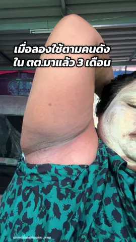 #ครีมรักแร้คามู #รีวิวบิวตี้ #ป้ายยาบิวตี้ #ใช้ดีบอกต่อ #ครีมรักแร้บอสหนุ่ม 