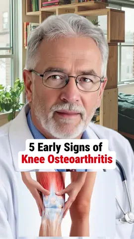 5 Early Signs of Knee Osteoarthritis #health #healthtips #osteoarthritis #usa_tiktok #usa🇺🇸 
