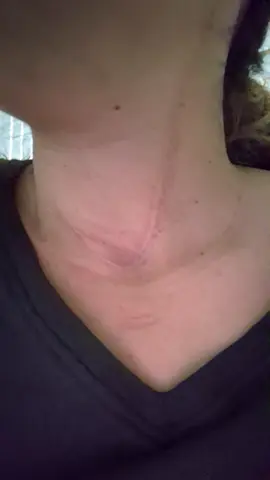 les avisaré con calma lo que me digan, animo a todos! si podemos💓 #fe#cancer#tiroides 