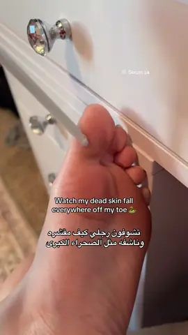 النتايج صدمه 🤯 تشيل القشور او الجلد الي يكون قاسي وناشف بالارجل وتشوفينه يتقشر قدامك بثواني كتقشير فوري👌🏻 رهيييبه وتبرد الخاطر ترا مفعولها جداً جداً ممتاز و تعتبر جداً لطيفه رغم انها امبولات تقشير، يعني لطيفه لدرجه انها ماتجفف الجلد بلعكس تتركه نضر ومترطب وتناسب كل انواع البشره وتستعمل حتى للوجه او باقي الجسم، متوفرة بموقعنا للطلب #عناية_بالبشرة #عناية #الرياض_الآن #ليزر #تقشير 