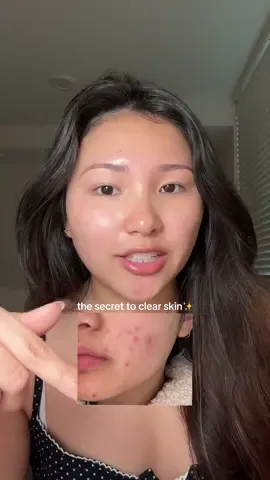 my secret formula to clear skin 🤍 @Peach Slices hypochlorous acid @anua_global heartleaf 77% soothing toner @IUNIK US beta-glucan power moisture serum anua ceramide panthenol moisture barrier cream #skinbarrier #skincareroutine #iunik #iunikbetaglucan #iunikhydrationserum