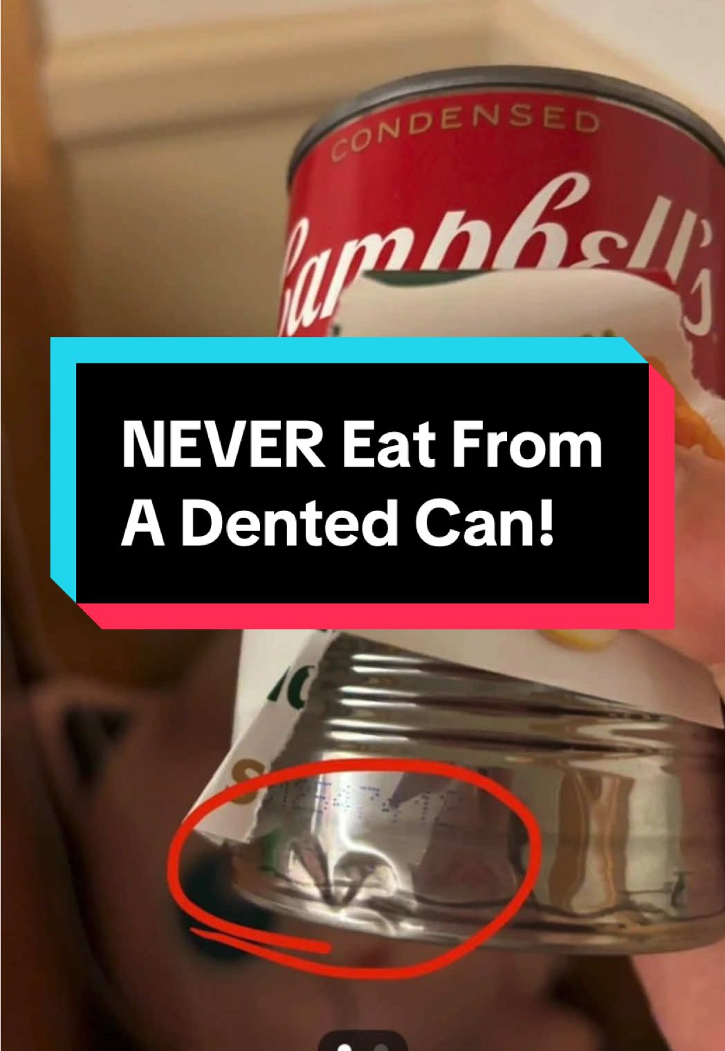 Dented cans might look harmless… But they can make you seriously sick 😳 Here’s what to check before you eat! 🥫 #PublicHealth #FoodSafety #MedicalTok #Botulism #HealthTips 