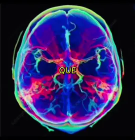 Cuándo te dá la pálida. 👀⬆️ #neurociencia #psicologia #ciencia #mari #paratiiiiiiiiiiiiiiiiiiiiiiiiiiiiiii 