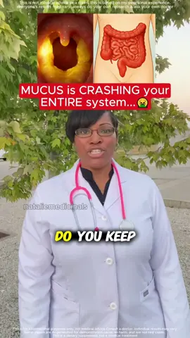 #vyxion #soursop #fyp #healthy #tiktokshopblackfriday 