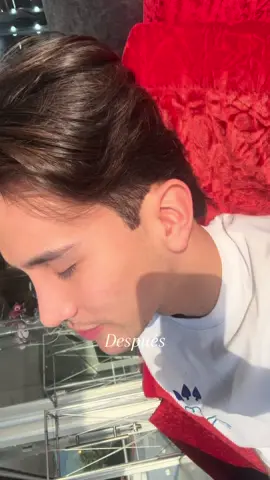 6 meses y así va mi proceso, claramente hay veces en las cuales no me siento cómodo o no me gusta lo que veo pero es parte de este proceso. Últimamente la he tenido muy inflamada pero es normal, así que solo queda esperar!! Igual estoy agradecido con mis resultados. (Necesito tips para desinflamar pls)  #nosejob #nosejobturkey #rinoplastia #process #selflove 