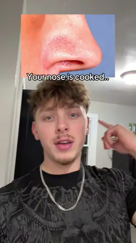 You prob need this #blackheadextractor 