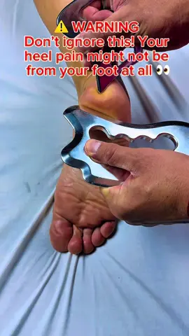 ⚠️ WARNING: Don’t ignore this! Your heel pain might not be from your foot at all 👀 This is deep fascia scraping — releasing years of tension locked inside your meridian system. What you’re seeing isn’t just massage… it’s a reset for your entire body’s bio-electric flow ⚡️ When the heel stagnates → it blocks energy up the spine, knees, hips, and even jaw. 🔥 One session can wake up your whole nervous system. #HeelPain #PlantarFasciitisRelief #KinesiologyMassage #GrastonTherapy #MeridianRelease     