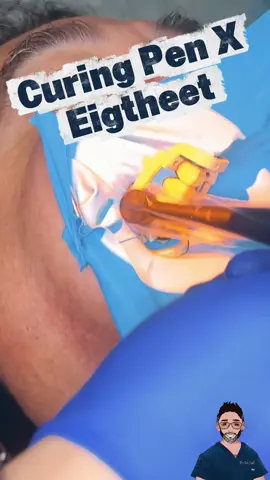 ¡Transforma cada restauración en una obra de arte clínico con la nueva Eighteeth Curing Pen X! 🔥 ✨ ¿Por qué es la aliada perfecta para tu práctica? 	•	Poliwave de alta potencia: tres niveles de activación que garantizan polimerización profunda y uniforme. 	•	Modo de diagnóstico + 8 configuraciones de trabajo: desde restauraciones directas hasta adheridas o post-endodónticas, tú eliges el parámetro exacto. 	•	Ergonomía de elite: cabezal ultradelgado de 8 mm, rotación 360°, y flujo de luz colimado para acceder zonas posteriores sin esfuerzo.  	•	Espectro amplio (≈ 385-515 nm) compatible con todos los composites de última generación.  	•	Ligera, potente y profesional: menos fatiga, más eficiencia. 🚀 ¿Listo para elevar tu rutina clínica?