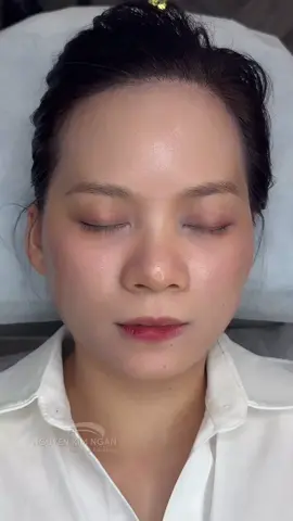 Sửa mày hư bằng kỹ thuật Sợi trên nền qua 2 lần laser #longmaydep #tiktok #xuhuong #tuankhaiphunxamnghethuat 