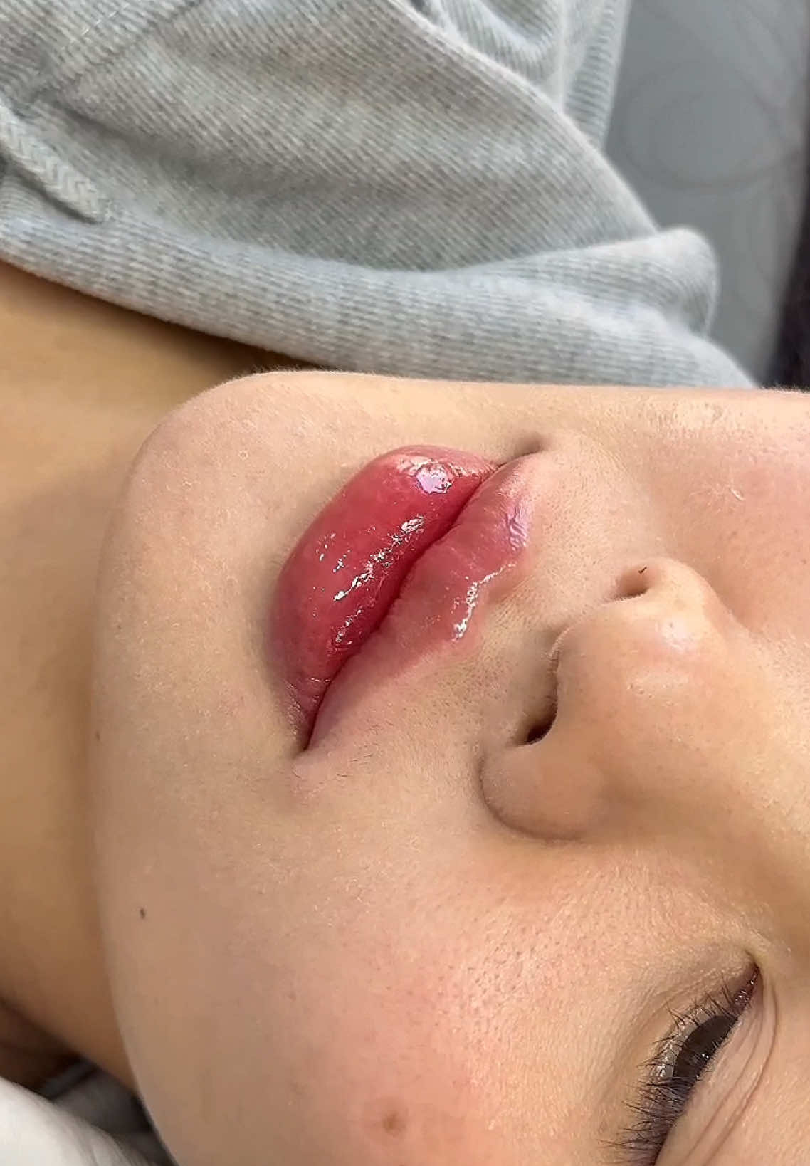 Môi cam thường cỡ này 👉👉👉 Bà nào mê quất liền cho tôi chỉ 1🍠5 #filer #tiemmoifiller #môixinh #tunhien #camthuong 