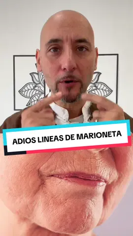 😱FUNCIONA😱 #arrugasfaciales #surconasogeniano #lineasdemarioneta 
