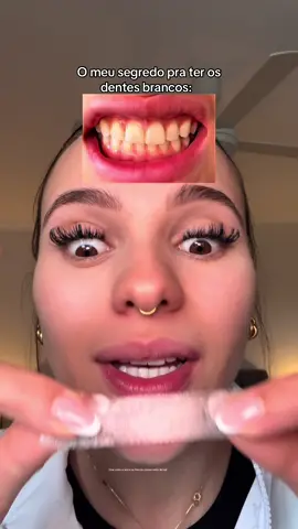 A melhor opção de clareamento que já era febra na gringa há muito tempo, agora chegou no Brasil! #clareamentodental #dentesperfeitos #dentesbrancos #fy 