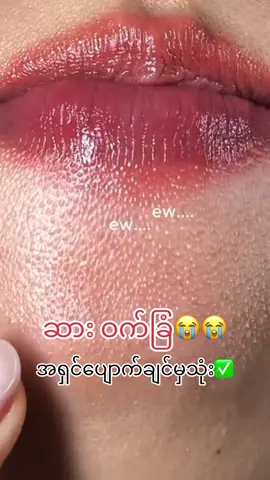 ဆားဝက်ခြံတကယ်ပျောက်ချင်မှသုံးပါ#မလေးရှားမြို့နယ်စုံပို့ပေးပါတယ် #ဝက်ခြံပျောက်ခြင်သူများ #mimiboo #မလေးရှားရောက်ရွှေမြန်မာများ #မလေးရှားကသူငယ်ချင်းများ 