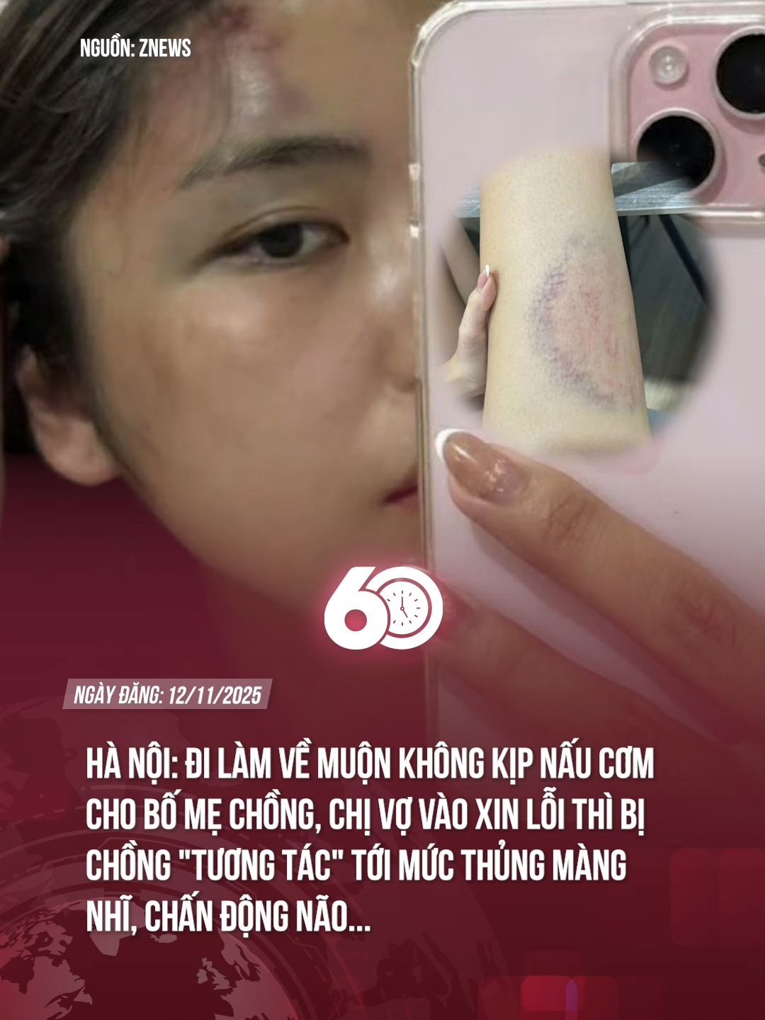 Hà Nội: Đi làm về muộn không kịp nấu cơm cho bố mẹ chồng, chị vợ vào xin lỗi thì bị chồng 