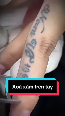 Bên mình có xoá cả xăm người nữa nhé mọi người#xoaxam #xoalaser 