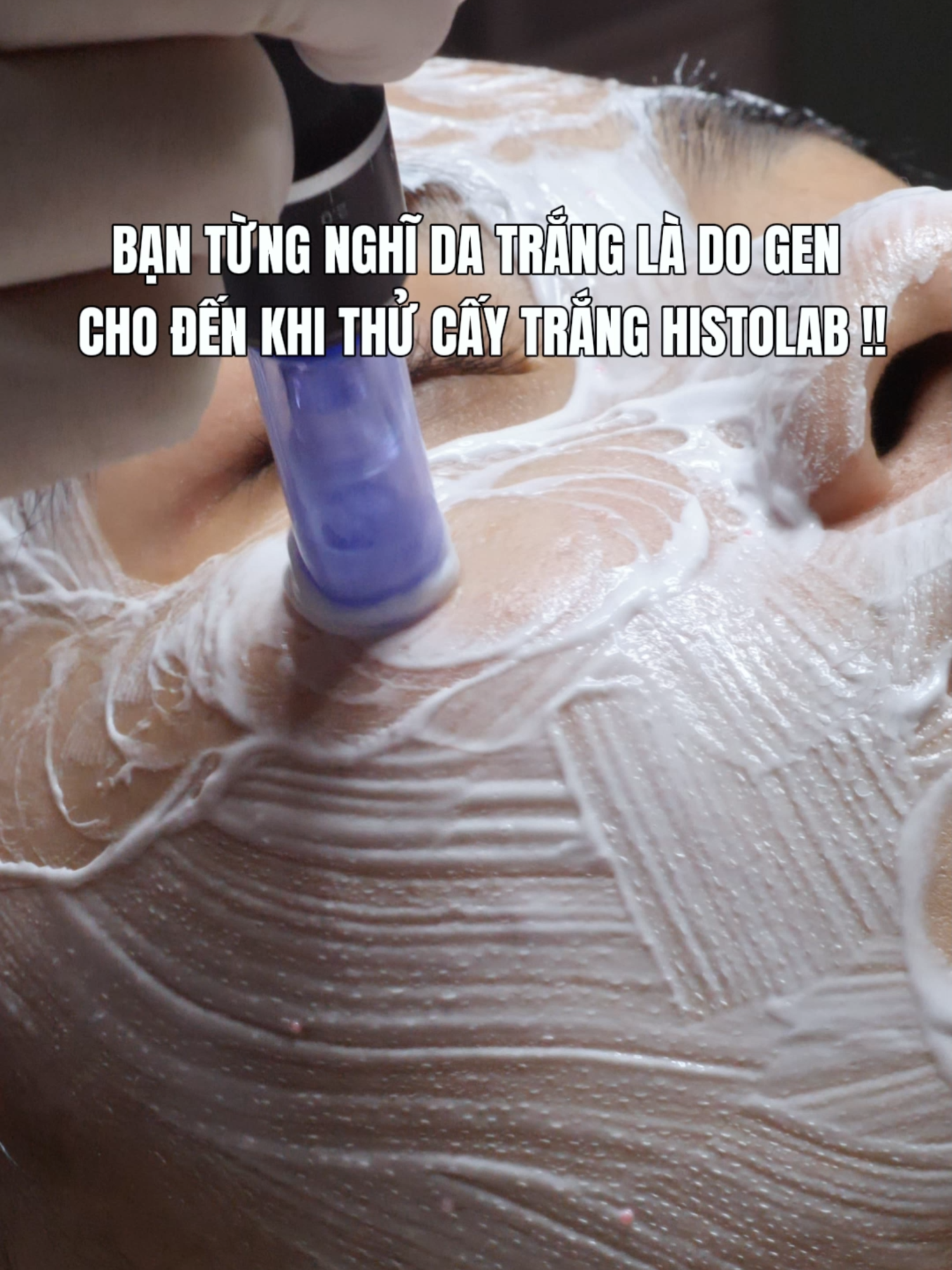 Bạn từng nghĩ da trắng là do gen cho đến khi thử cấy trắng Histolab !! #mialalanhatrang #spanhatrang #caytranghistolab #spa #xh