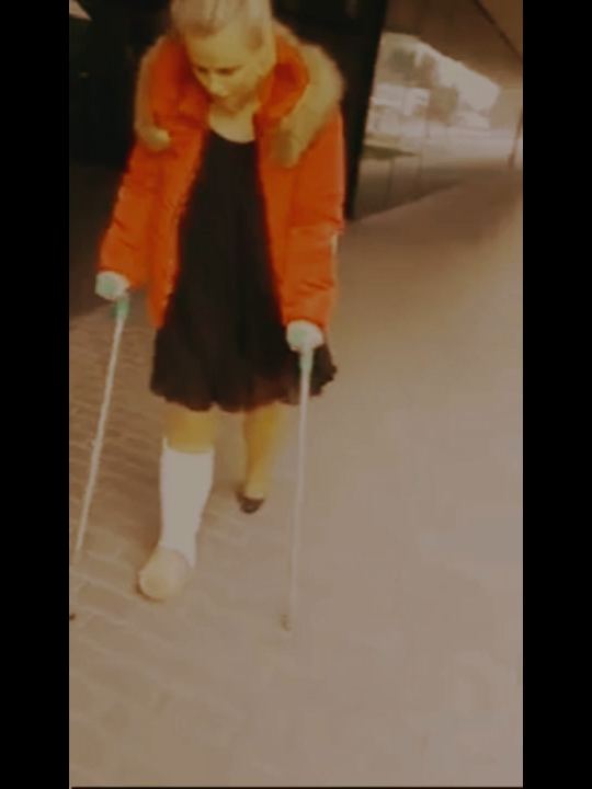 #gipsfuß #cast #crutches #krücken #platre #gips #gesso #nylons #stockings