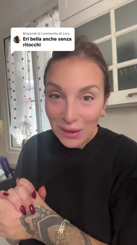 Risposta a @Lory #risposte #rispondo #commenti #fillers💉 #hyaluronicacid 