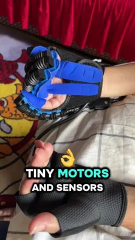 #strokerehabilitation #homeexercise #strokesurvivor #robotichand #glove 