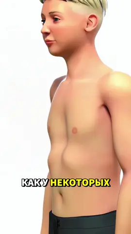 #fyp#foryou#3Dпопуляризациянауки#медицина#операция 