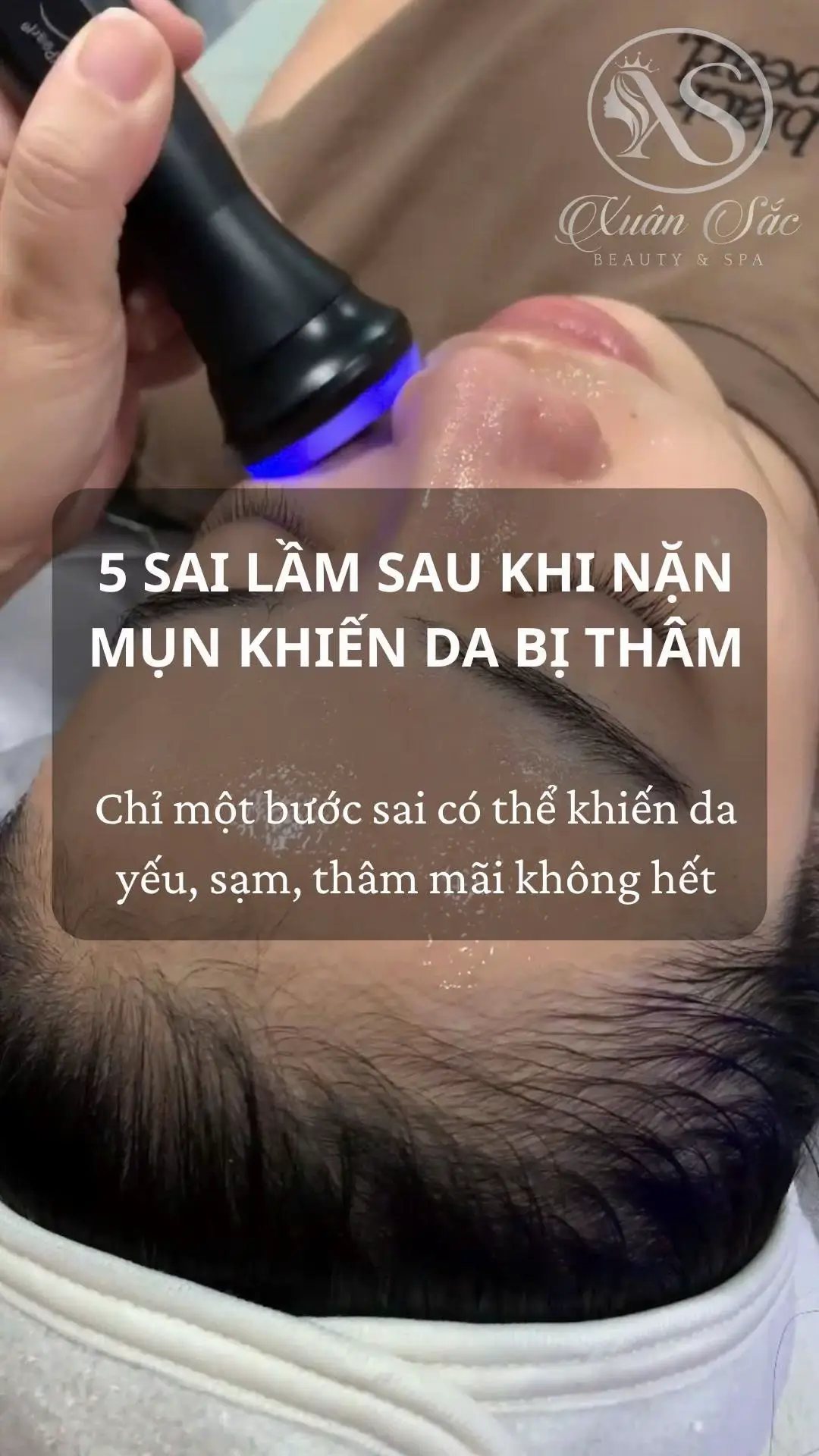 Nặn mụn xong nếu không xử lí chăm da đúng cách rất dễ làm da bị thâm , cùng nhau học thêm các kiến thức chăm da hằng ngày nhé. #chamsocda #daotaohocvien #spaphunhuan #xuhuong #xuansacbeauty 