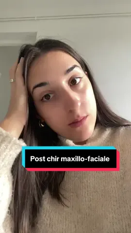 Jeudi 20 : le premier rendez-vous avant le début d’un long combat. De mes 10 à mes 15 ans, j’ai porté un appareil dentaire (haut et bas), car on m’avait dit que c’était la seule solution si je ne voulais pas subir une opération de la mâchoire. Après avoir retiré les bagues, tout allait bien : dents alignées, mâchoire bien en place… jusqu’à il y a 3 ou 4 ans. Petit à petit, ma mâchoire a commencé à se dégrader : décalage progressif, craquements, blocages quand je voulais bailler, douleurs quand je m’allongeais sur le côté… Bref, rien n’allait plus. J’ai alors voulu repasser par de l’orthodontie, mais malheureusement, on m’a expliqué que la seule solution désormais serait une opération maxillo-faciale. On m’a appris que ma mâchoire était complètement décalée, avec une luxation. Cela a même entraîné, quelques années plus tôt, un décalage du bassin, des vertèbres mal placées et une jambe plus courte d’environ 1 cm. J’ai aussi eu de fortes douleurs à l’oreille par moments. On m’a expliqué que sans cette opération, je risquais, avec le temps, de développer de l’arthrose à la mâchoire, ce qui pourrait m’empêcher de m’alimenter correctement et même de parler, car elle finirait par s’effriter. Je me vois donc dans l’obligation de passer par là. Évidemment, j’ai très peur… J’en saurai un peu plus jeudi prochain, mais le stress commence déjà à monter. Bien sûr, je vous partagerai la suite de cette aventure. 👉 Si vous voulez connaître mon parcours depuis le tout début, n’hésitez pas à me le demander, je vous l’expliquerai avec plaisir ! #maxillofaciale #machoire #operation #operationmaxillofaciale #orthodentie 