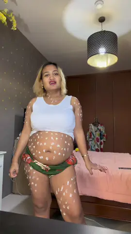 #ciaraindonesia #stretchmark #stretchmarkserum #stretchmarkoil #stretchmarks 