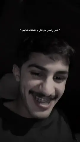 تعالو الأصفر ( ZZT-X ) ⭐️ . #ريان_القحطاني #fyp #viral 