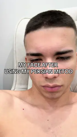 #looksmaxing ig:saintdruge