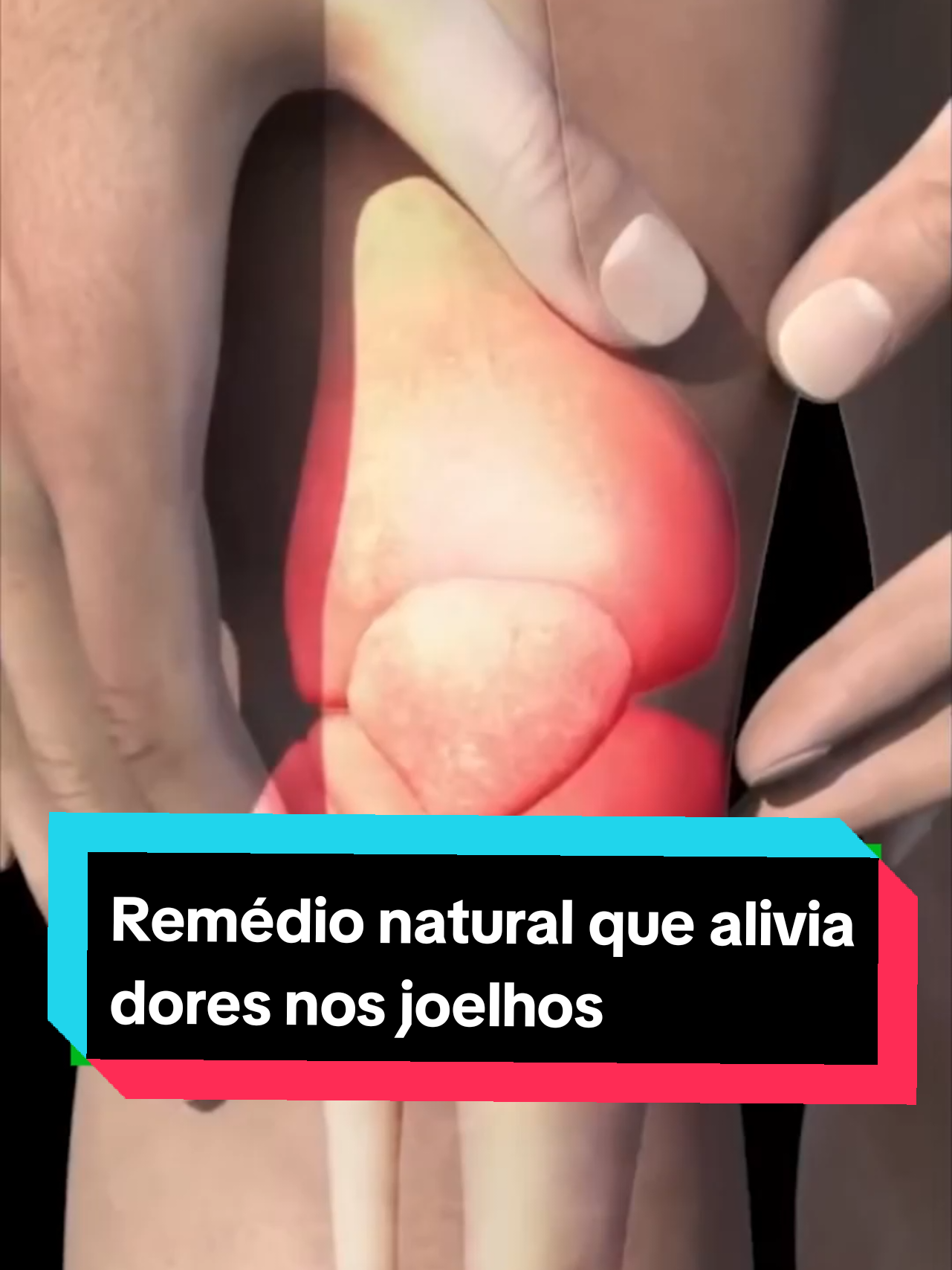 Remédio natural que alivia dores nos joelhos e articulações em apenas 5 dias 🌿 #receita #receitanatural #receitasaudável 