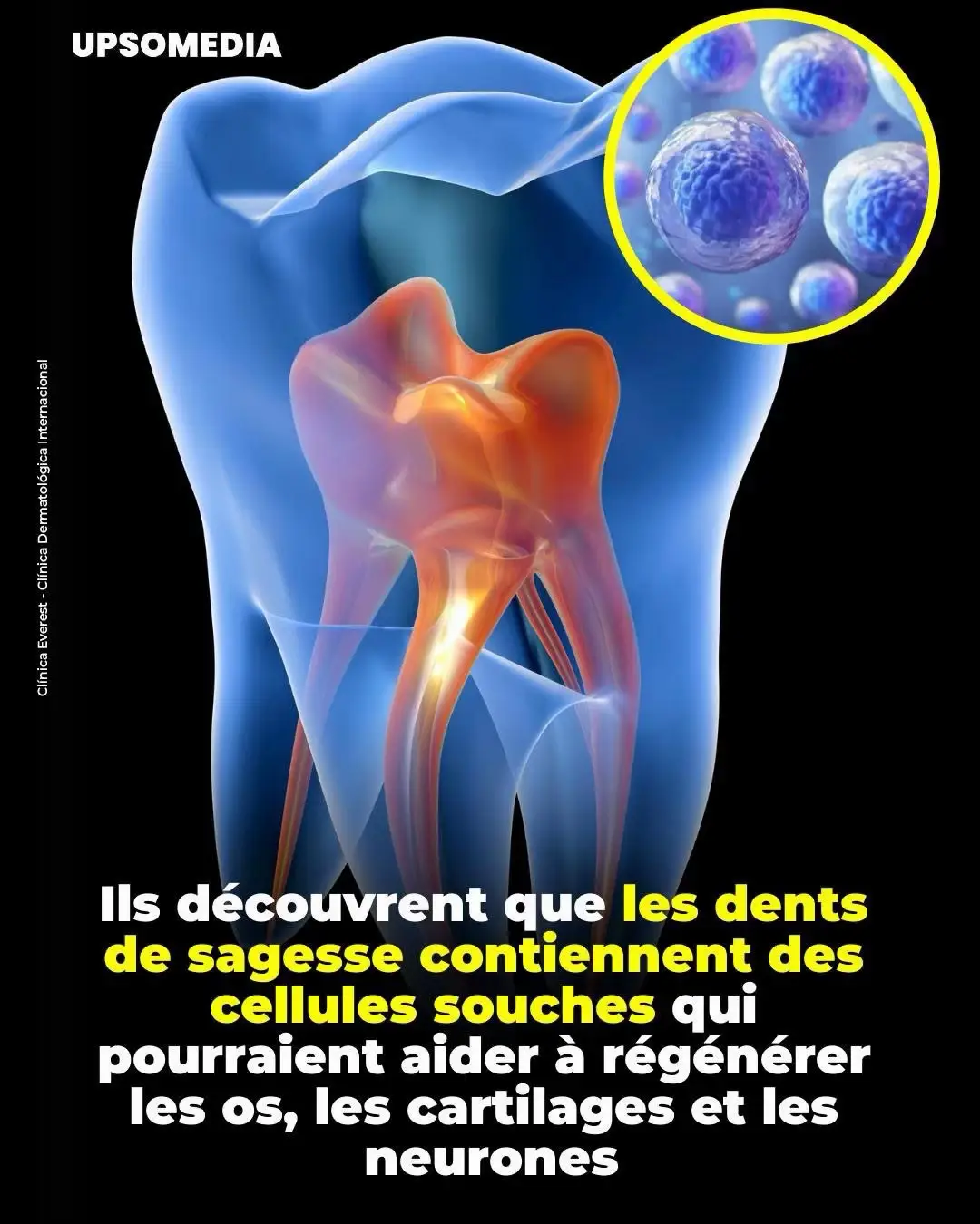 #dent #sante #remedenaturel #guerison #fyp 