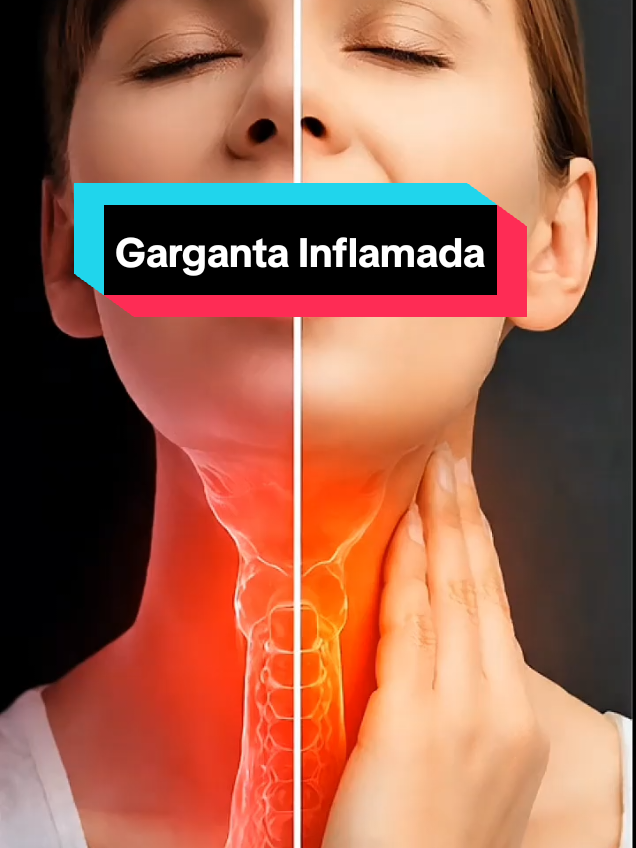 ¿Por qué se inflama la garganta?🤔 #garganta #AprendeConTikTok #enfermedad #enfermedades #cienciaentiktok 