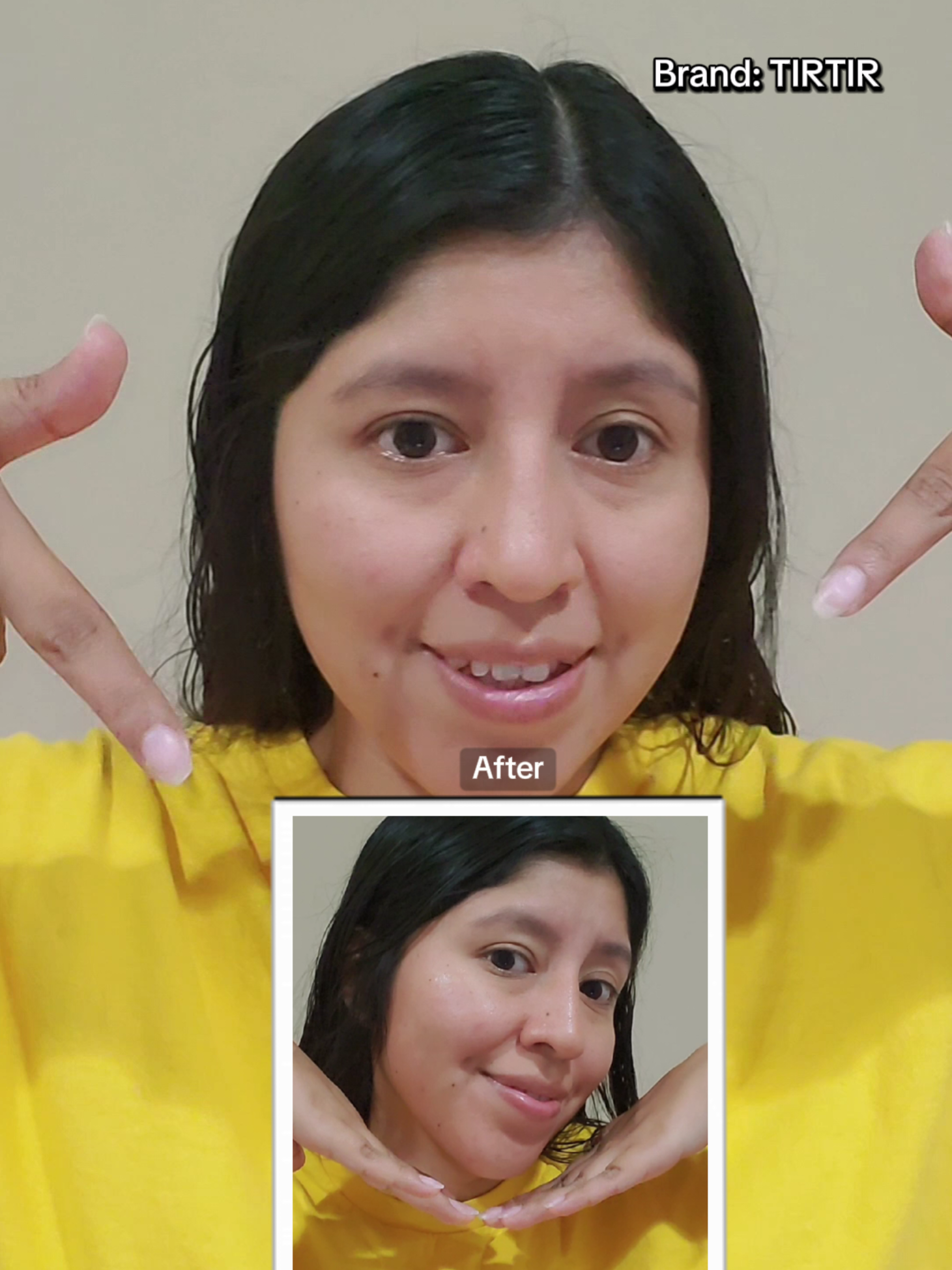 ⭐️ Clinically proven to hydrate, calm irritation, and visibly reduce redness! Brand @TIRTIR Inc.  Azelaic Acid 12% Serum #tirtir #skincare #kbeauty #fyp #glassskin 