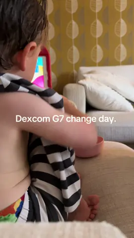 CGM change day on my 3yr old. Dexcom g7#type1diabetes #Dexcom #typeonewarrior #dexcomg7change 