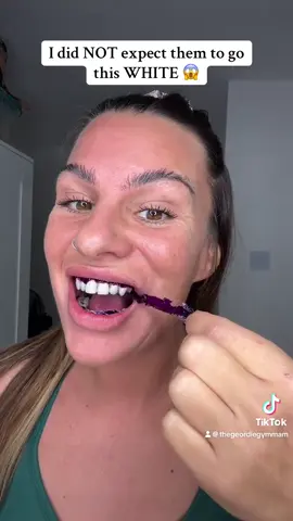 Wow effect 💔 #purplestrips #whiteningstrips #drdent #teethwhitening #oralhealthtips 