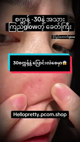 30စက္ကန့်နဲ့ ပြောင်းလဲလို့ရတဲ့ခေတ်ကြီးမှာဒါလေးသုံးကြည့်#fyp#skincare #helloprettybeautyshop #skincareviral #menokinbubblemask 