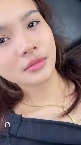 #fillerbotox #filermoi #hanoi #fyp 