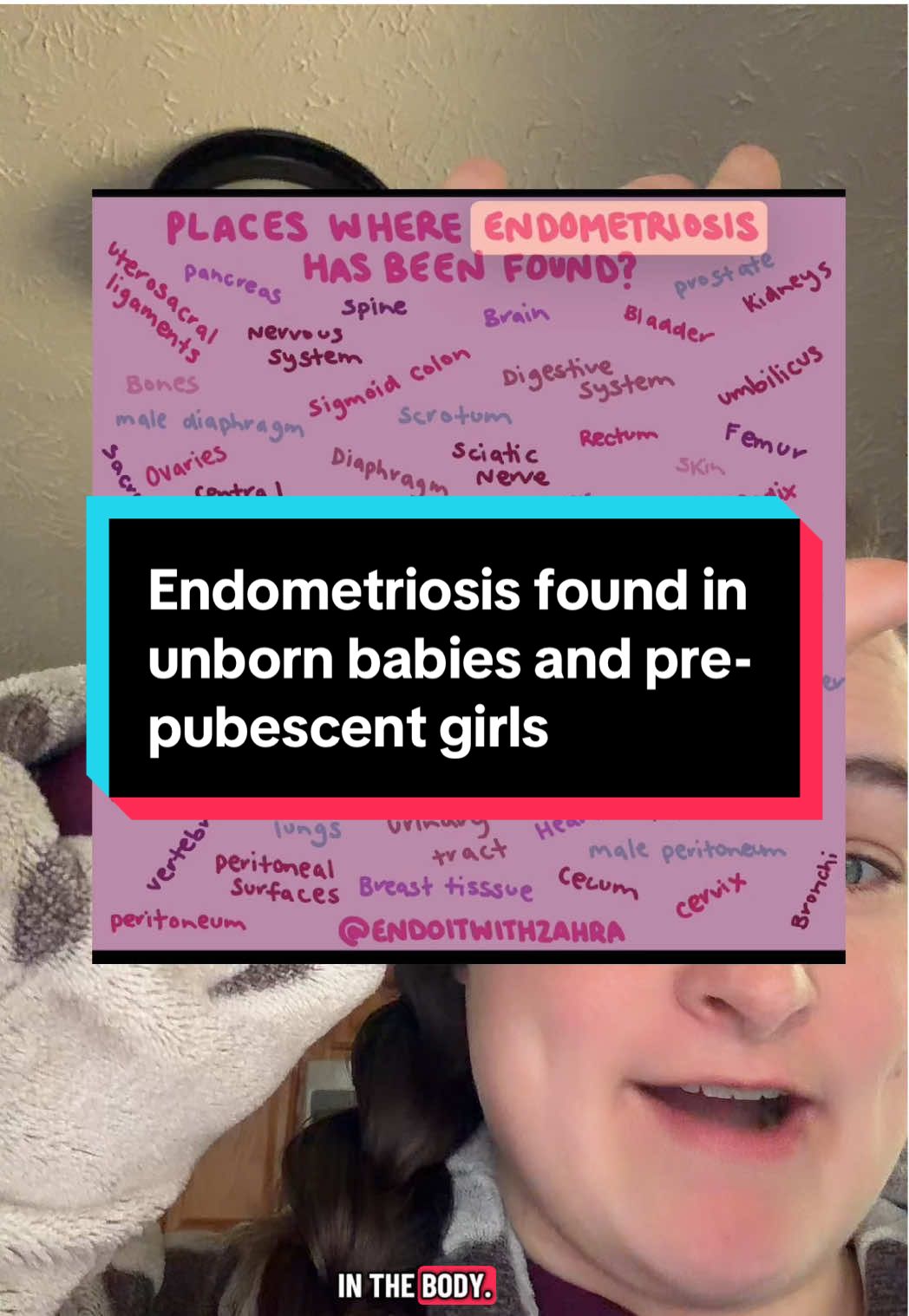 Endometriosis found in unborn babies and pre pubescent girls, as young as 7.  Endometriosis has been found all over the body, including the eyes, lungs, spine, etc.  Credit to @endoitwithzhara on IG for sharing this. #endo #endometriosis #womenshealth #fyp #foryoupage 