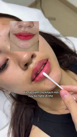 Khoé đi 1 đường mấu đi 1 đường kk #Change_Medical_Aesthetic 