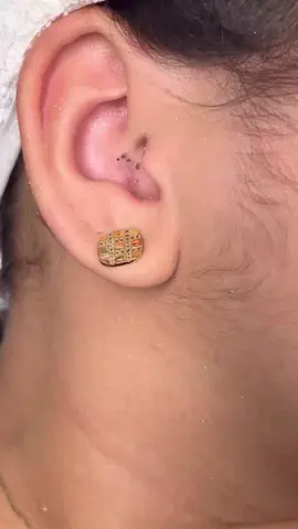 #extracaodecravos #espinha #satisfatóriosvideos #satisfaction #espinhasecravos 