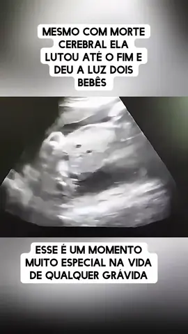 #noticia #jornalismo #reportagem #noticiastiktok #noticias 